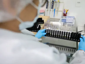 Fiocruz obtém patente para tratamento contra malária resistente