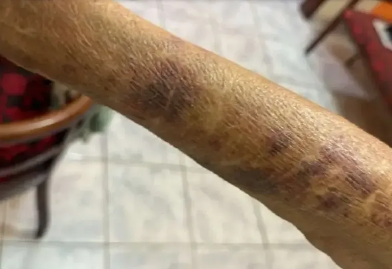 Filho é preso após agredir, ameaçar e extorquir mãe idosa em Nova Venécia