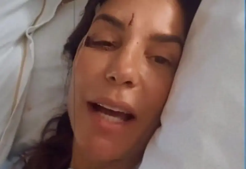 Ivete Sangalo é internada em Salvador após sofrer desmaio por desidratação