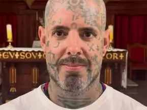 Tico Santta Cruz relata 'recaída' após enfrentar forte crise: 'Fiquei péssimo'  