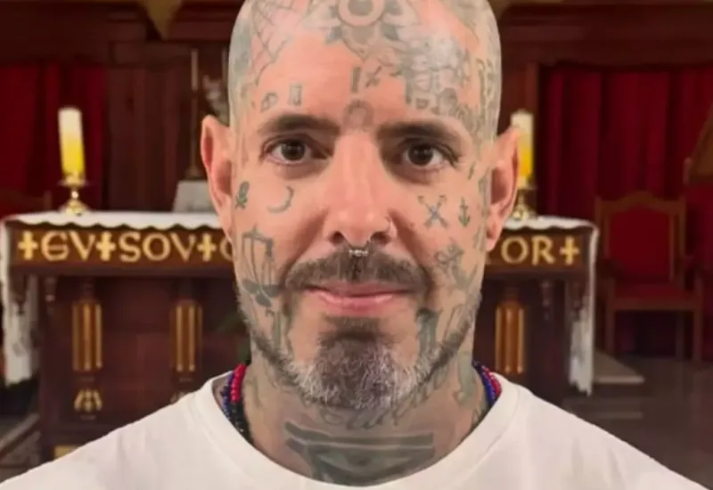 Tico Santta Cruz relata 'recaída' após enfrentar forte crise: 'Fiquei péssimo'  